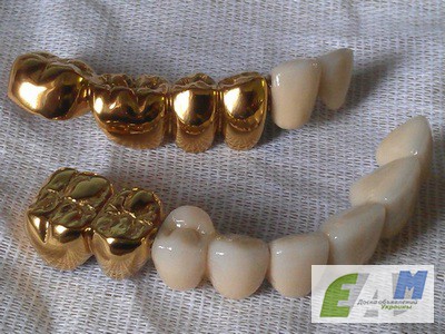 Фото 6. Вакуумные установки для нанесения покрытий под золото на зубные протезы из Беларуси